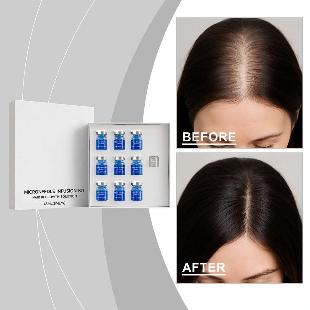 0,25mm Haar-Essenz-Serum Mikro – Derma Roller 0.25 Bewertung und Preis
